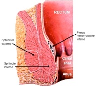 Chirurgie hemorroides Tunisie - types d'affection anales